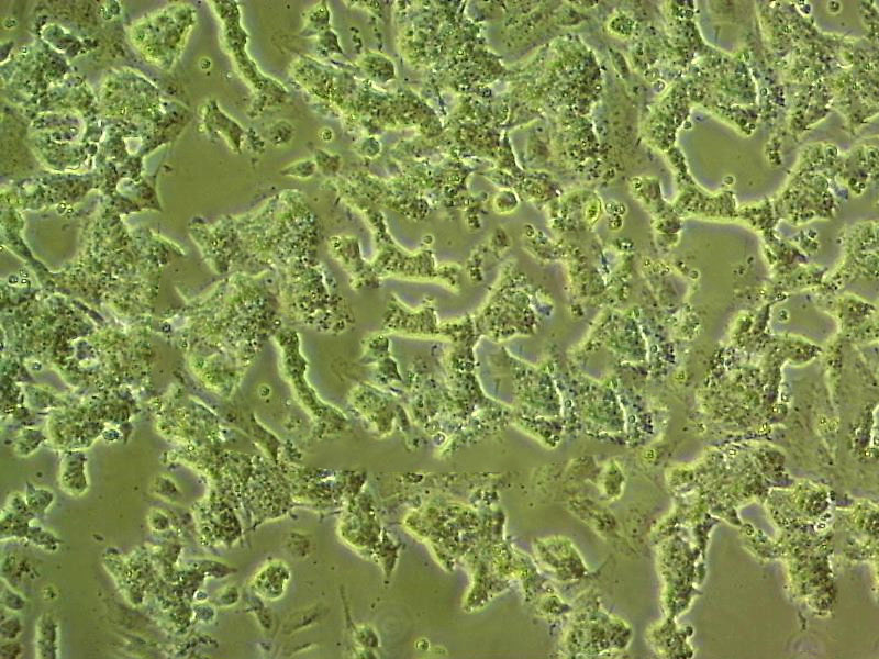 C918 Epithelial Cell|人眼脉络黑色瘤传代细胞(有STR鉴定)