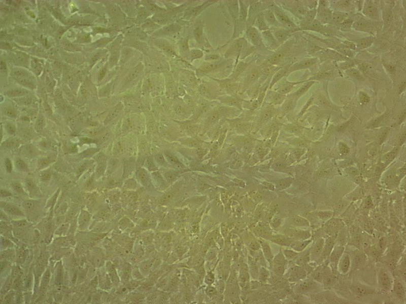 Panc02 Epithelial Cell|小鼠胰腺癌传代细胞(有STR鉴定)