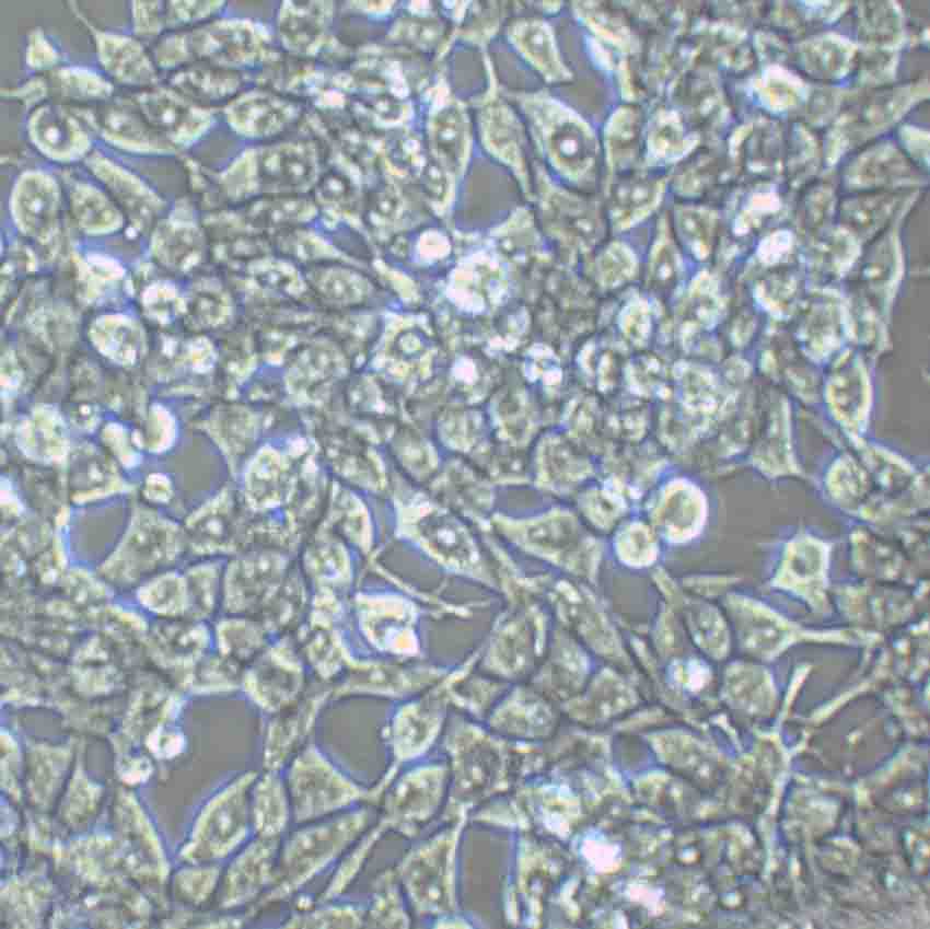 Eca-109 Epithelial Cell|人食管癌传代细胞(有STR鉴定)