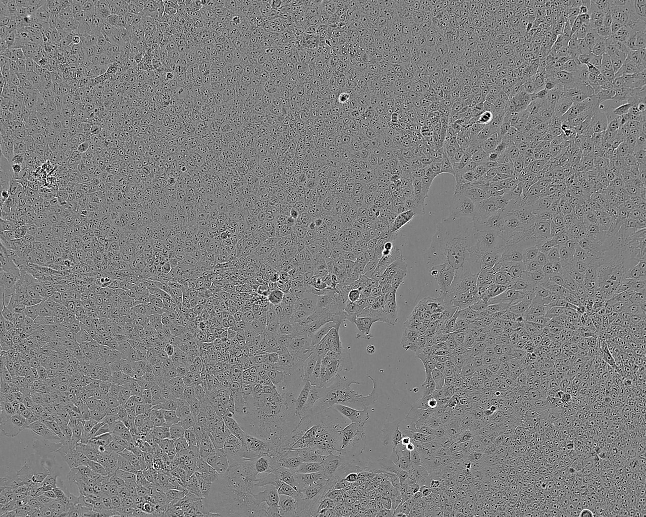 SK-OV-3 Epithelial Cell|人卵巢癌传代细胞(有STR鉴定)