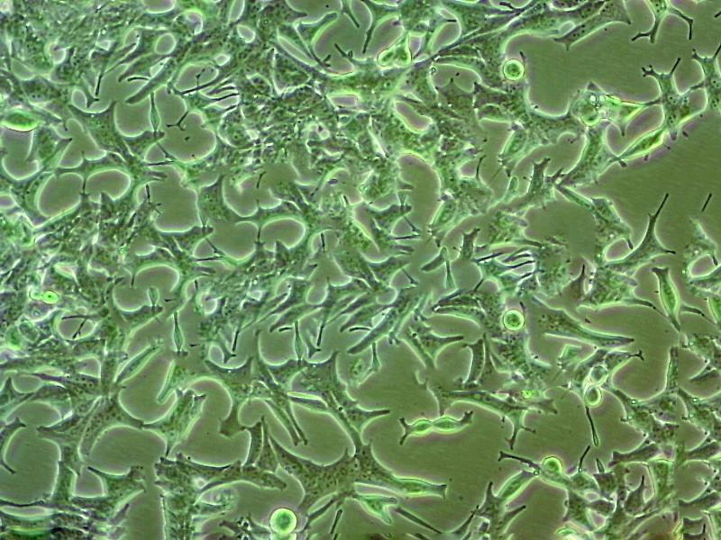 SCL-I Epithelial Cell|人皮肤磷癌传代细胞(有STR鉴定)