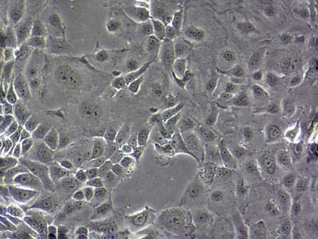 HTR-8/SVneo Epithelial Cell|人绒毛膜滋养层传代细胞(有STR鉴定)