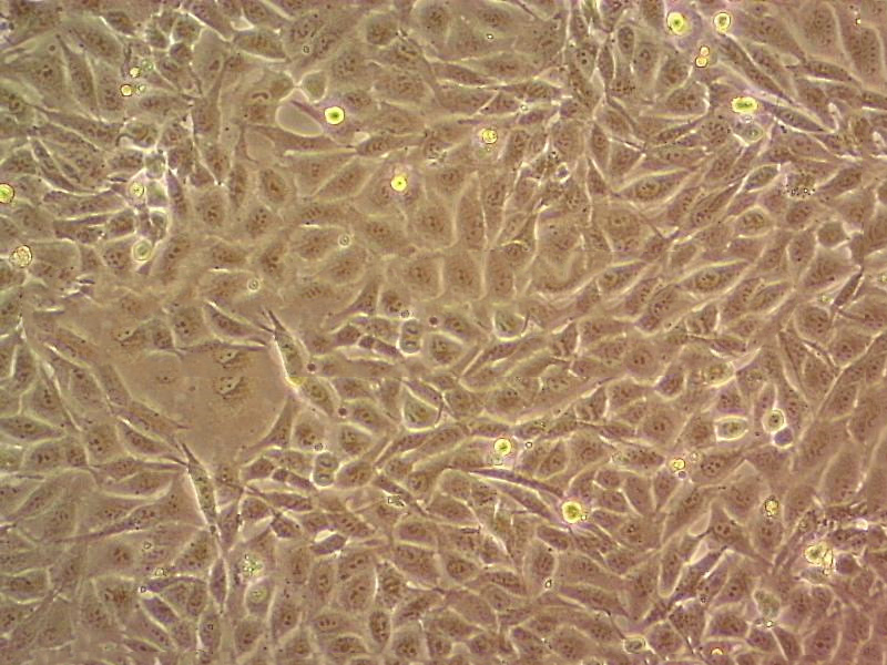MC3T3-E1 Subclone 14 Epithelial Cell|小鼠颅顶前骨传代细胞(有STR鉴定)