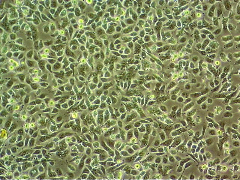 RF/6A Epithelial Cell|猴脉络膜-视网膜(内皮)传代细胞(有STR鉴定)