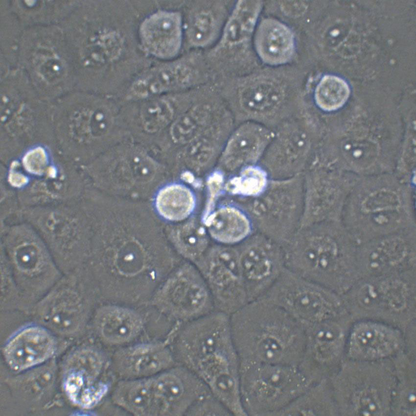 HuH-28 Epithelial Cell|人胆管癌传代细胞(有STR鉴定)