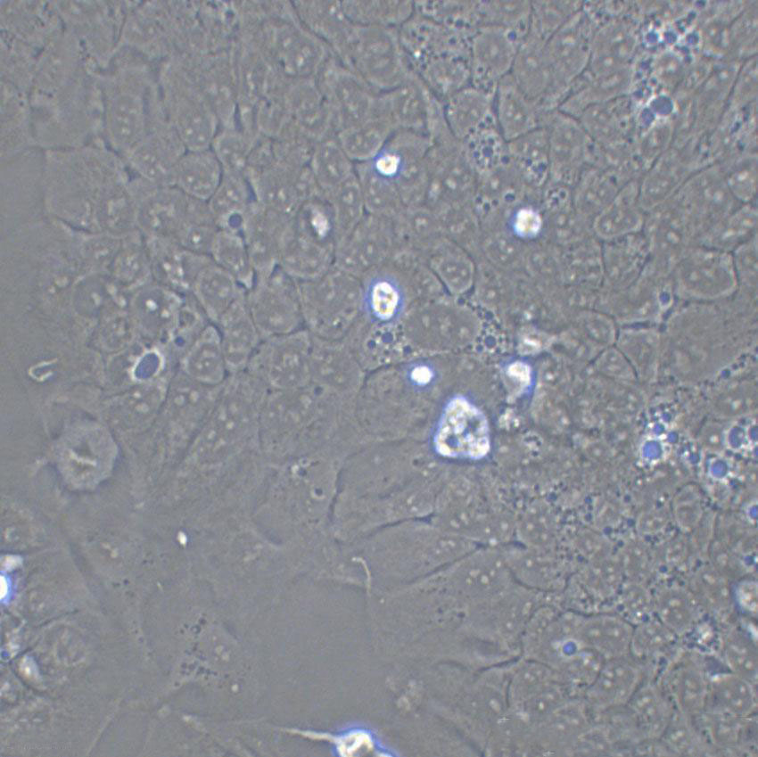 NCI-H1417 Epithelial Cell|人小细胞肺癌传代细胞(有STR鉴定)
