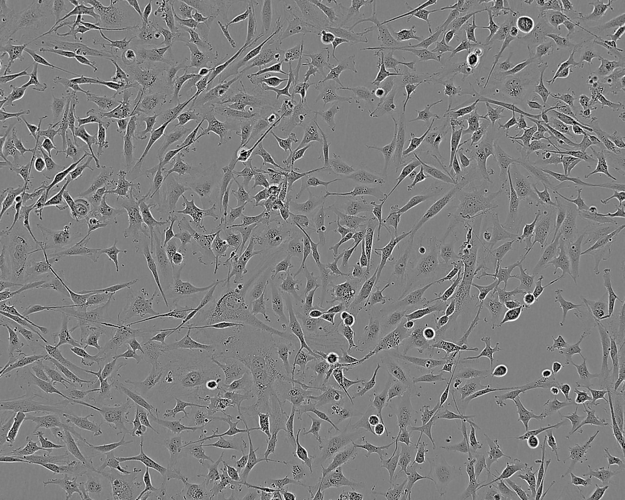 DiFi Epithelial Cell|人结直肠癌传代细胞(有STR鉴定)