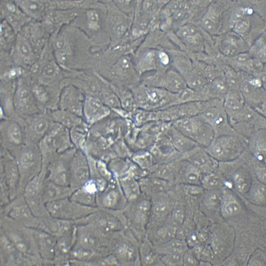 RPMI-2650 Epithelial Cell|人鼻腔上皮传代细胞(有STR鉴定)