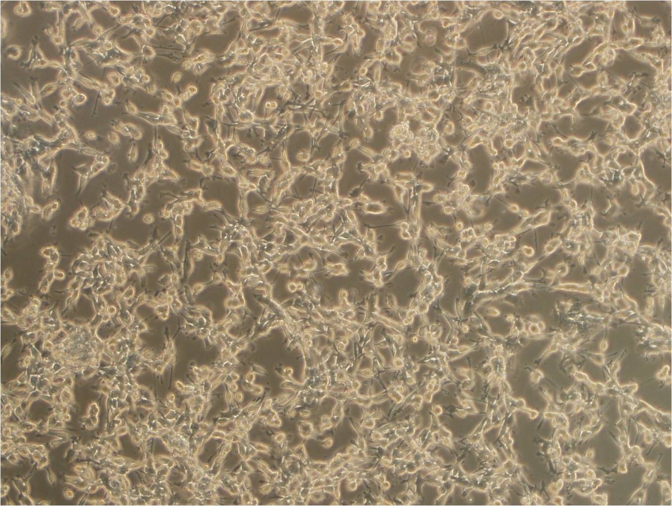 U-373MG ATCC Epithelial Cell|人胶质瘤传代细胞(有STR鉴定)