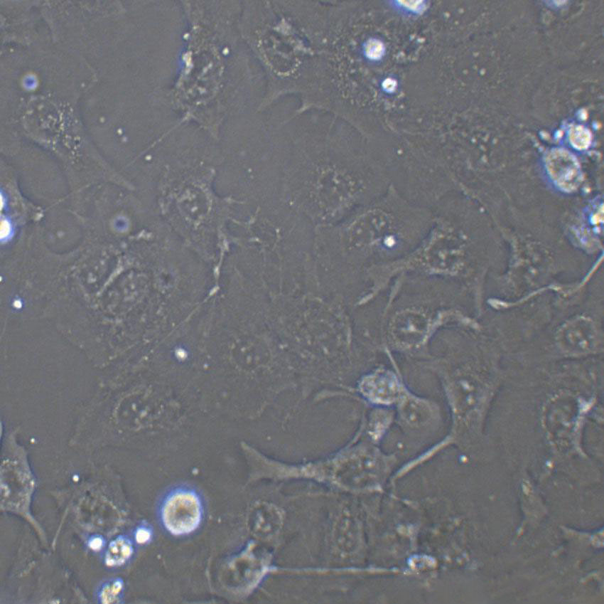 K7M2-WT Epithelial Cell|小鼠骨肉瘤成骨传代细胞(有STR鉴定)