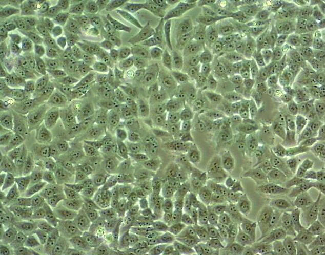 hEM15A Epithelial Cell|人永生化子宫内膜异位症患者在位内膜间质传代细胞(有STR鉴定)