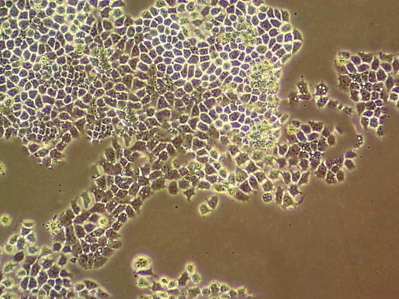 Ect1/E6E7 Epithelial Cell|人宫颈永生化鳞状传代细胞(有STR鉴定)