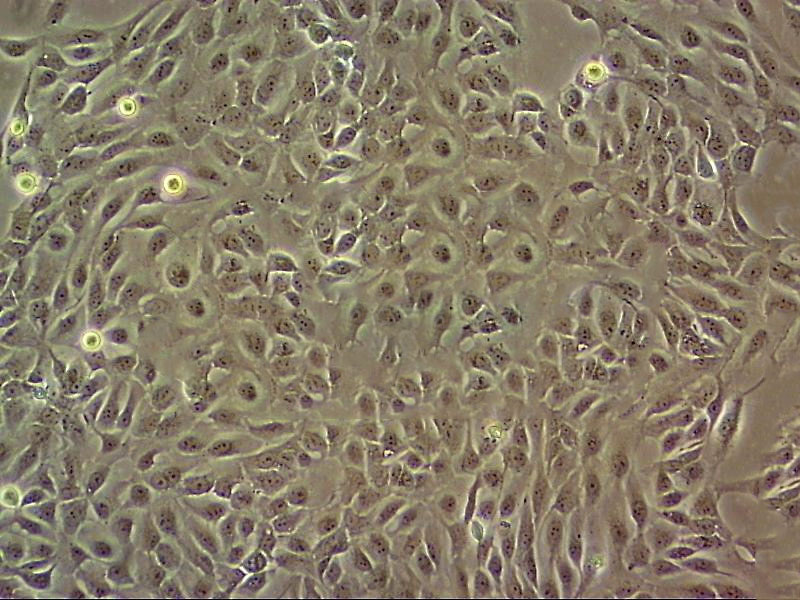 COLO 320HSR Fresh Cells|人结直肠腺癌细胞(送STR鉴定图谱)