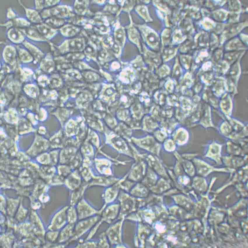 NCI-H508 Fresh Cells|人结肠直肠腺癌细胞(送STR鉴定图谱)