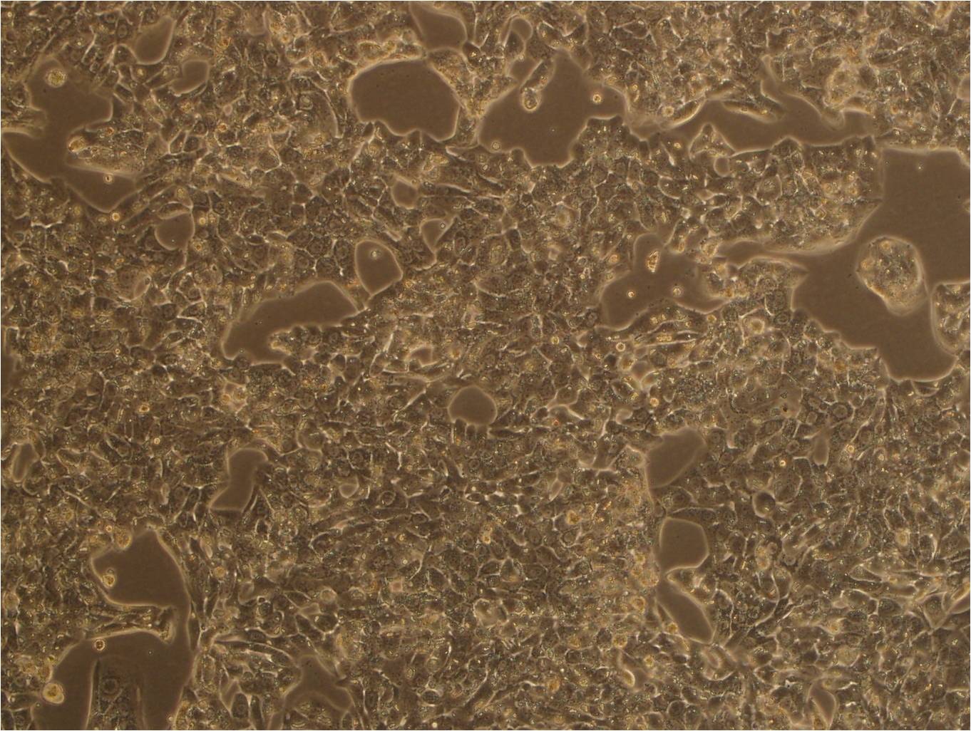 SW579 Fresh Cells|人甲状腺鳞癌细胞(送STR基因图谱)