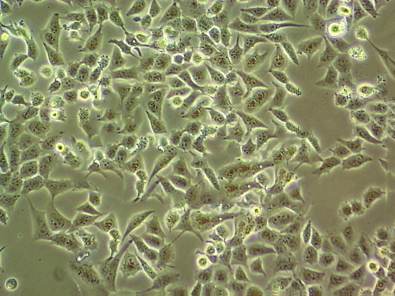 UM-UC-3 Fresh Cells|人膀胱移行癌细胞(送STR基因图谱)