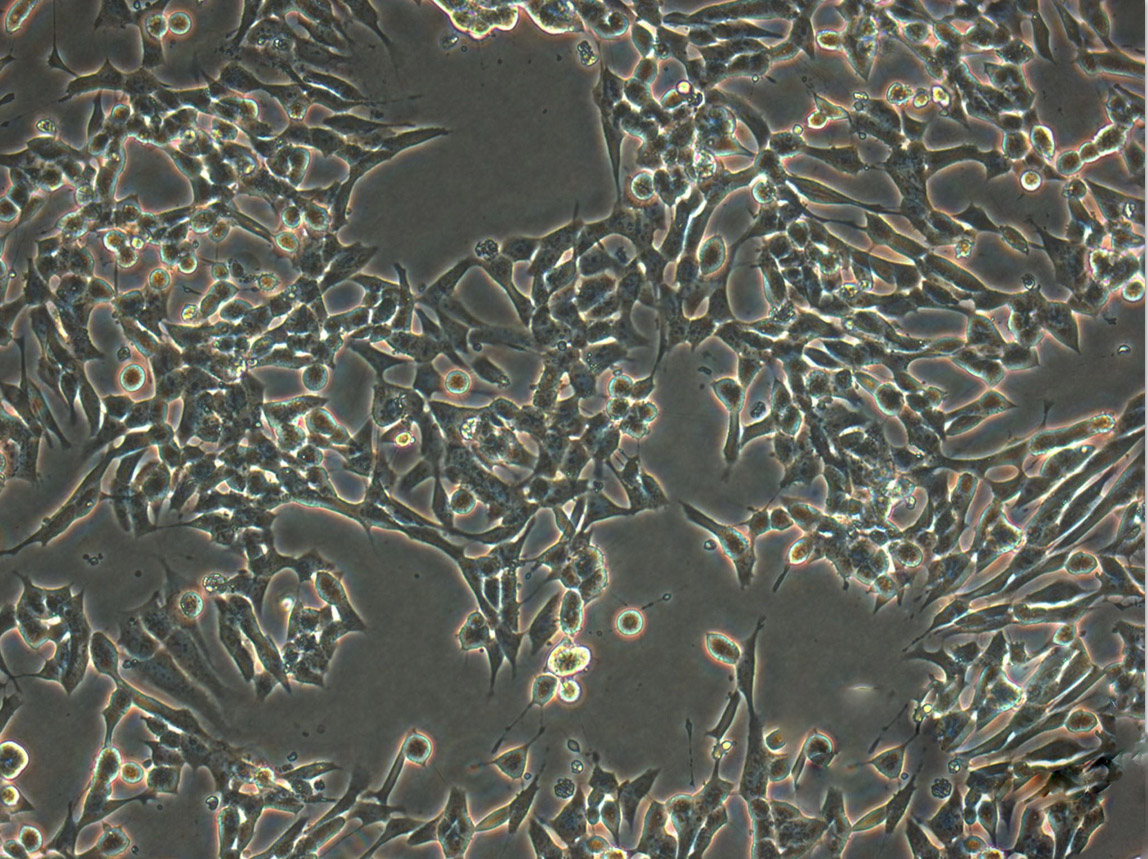 HBL-100 Fresh Cells|人整合SV40基因的乳腺上皮细胞(送STR基因图谱)