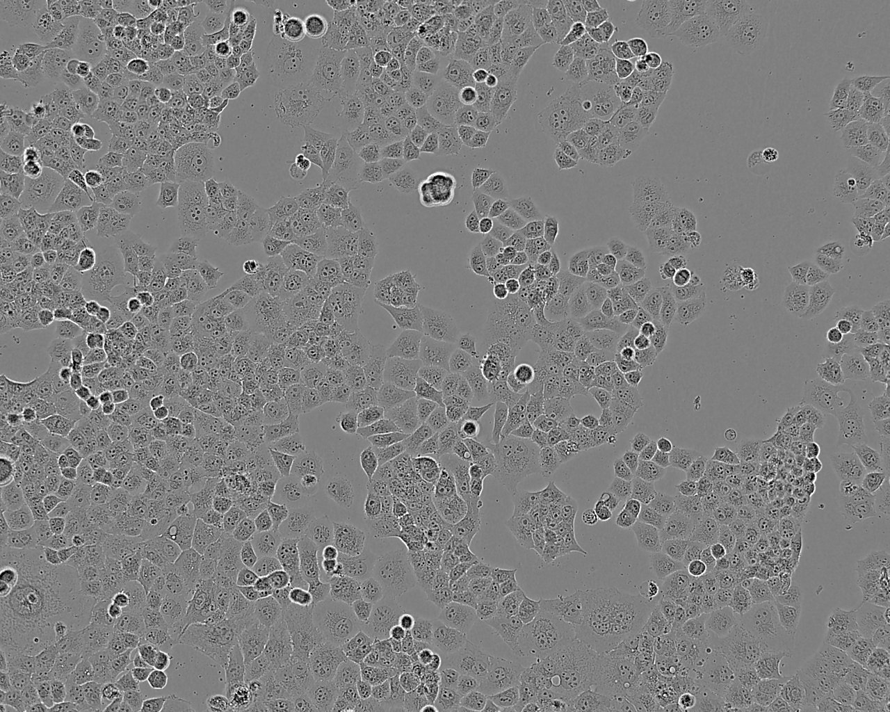 RL95-2 Fresh Cells|人子宫内膜癌细胞(送STR基因图谱)