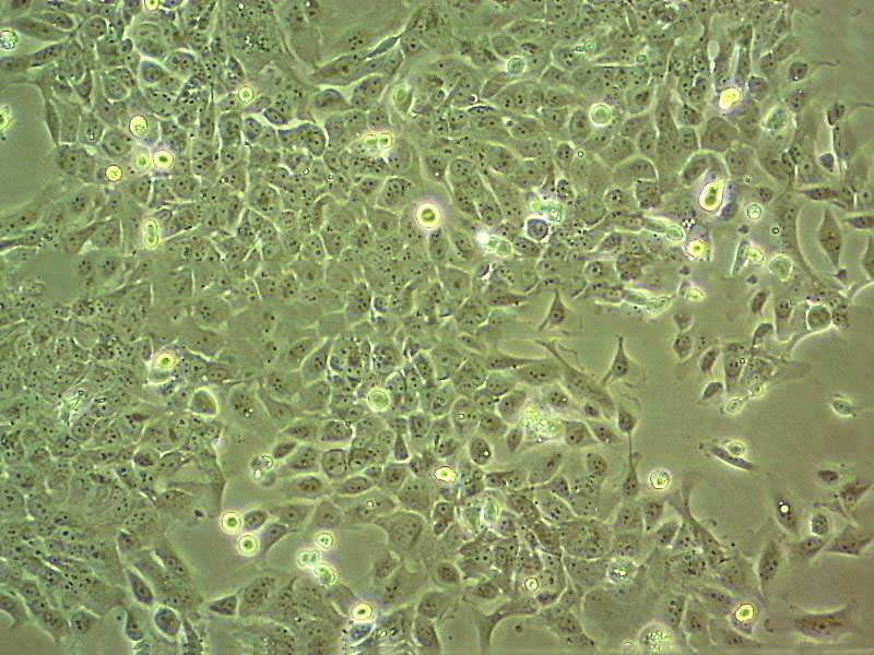 HeLa Fresh Cells|人宫颈癌细胞(送STR基因图谱)