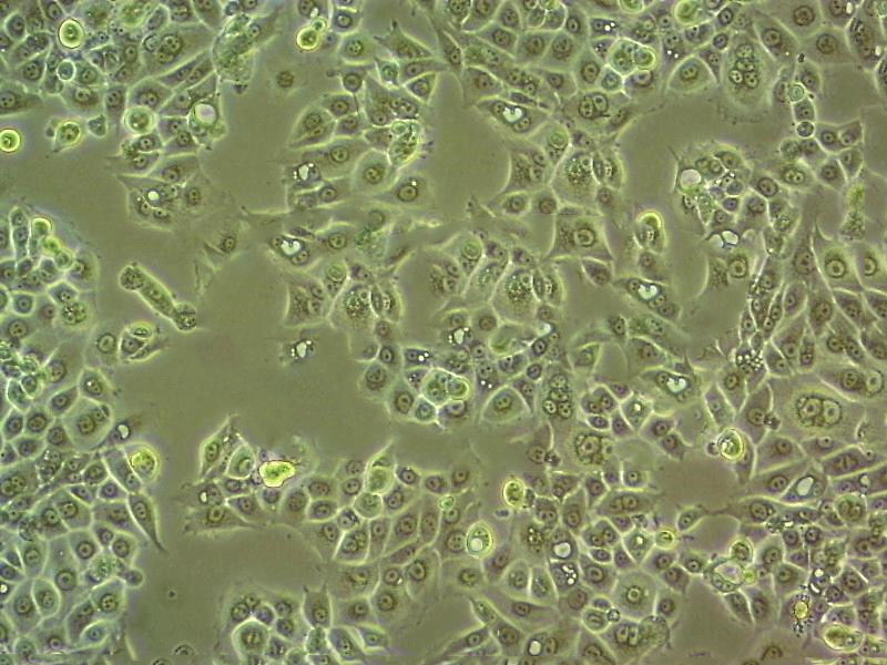 Ca Ski Fresh Cells|人宫颈癌肠转移细胞(送STR基因图谱)