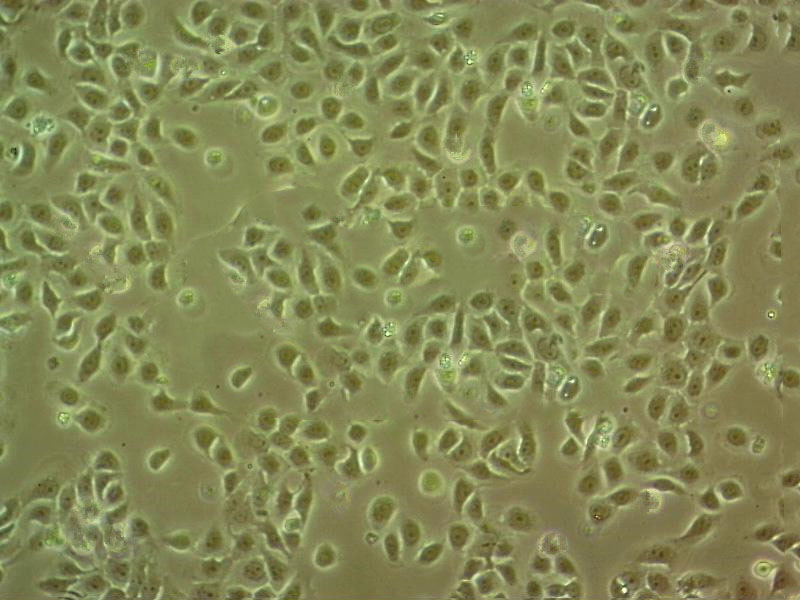 BEAS-2B Fresh Cells|人支气管上皮细胞(送STR基因图谱)