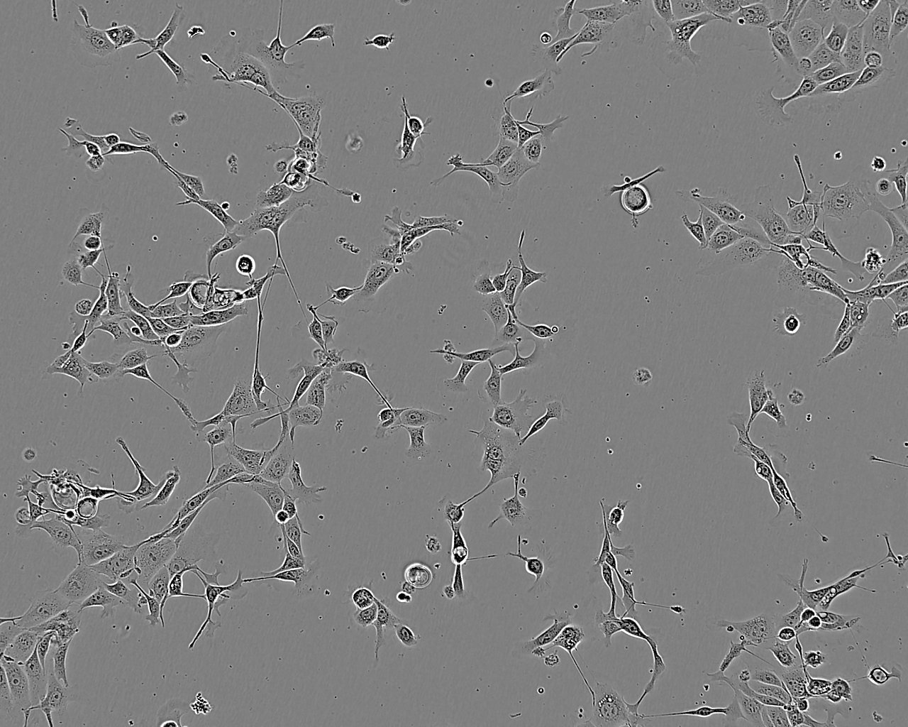 MDA-MB-436 Fresh Cells|人乳腺癌细胞(送STR基因图谱)