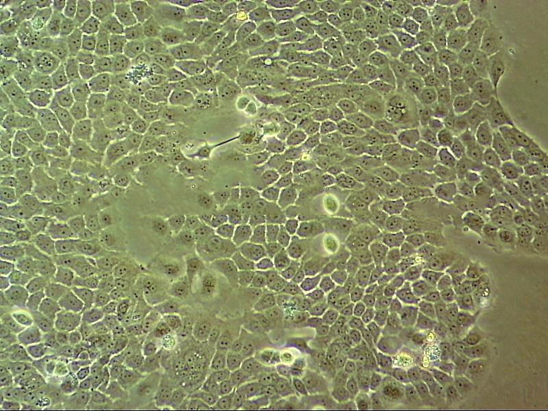 HCC2157 Fresh Cells|人乳腺导管癌细胞(送STR基因图谱)