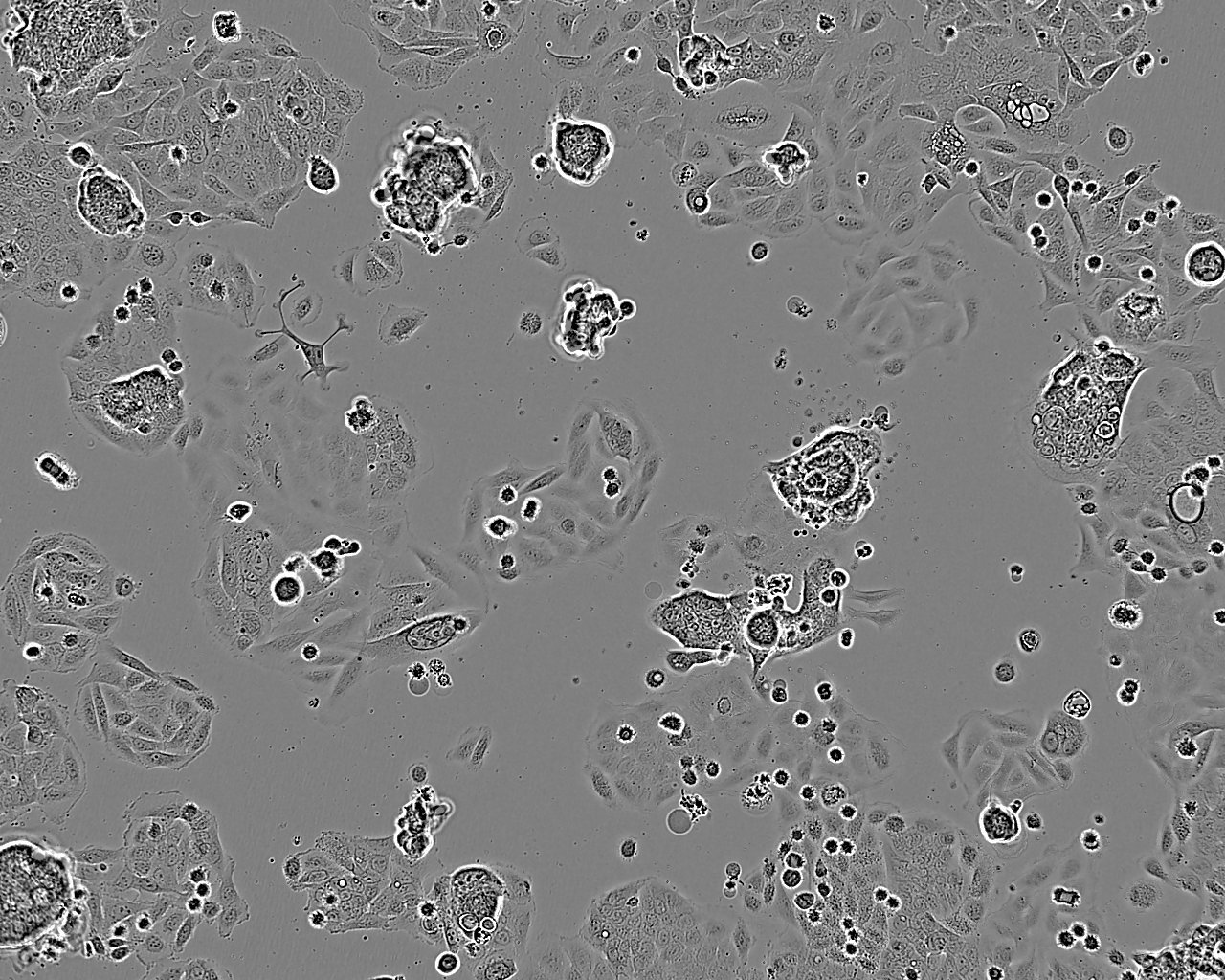 ACHN Fresh Cells|人肾细胞腺癌细胞(送STR基因图谱)