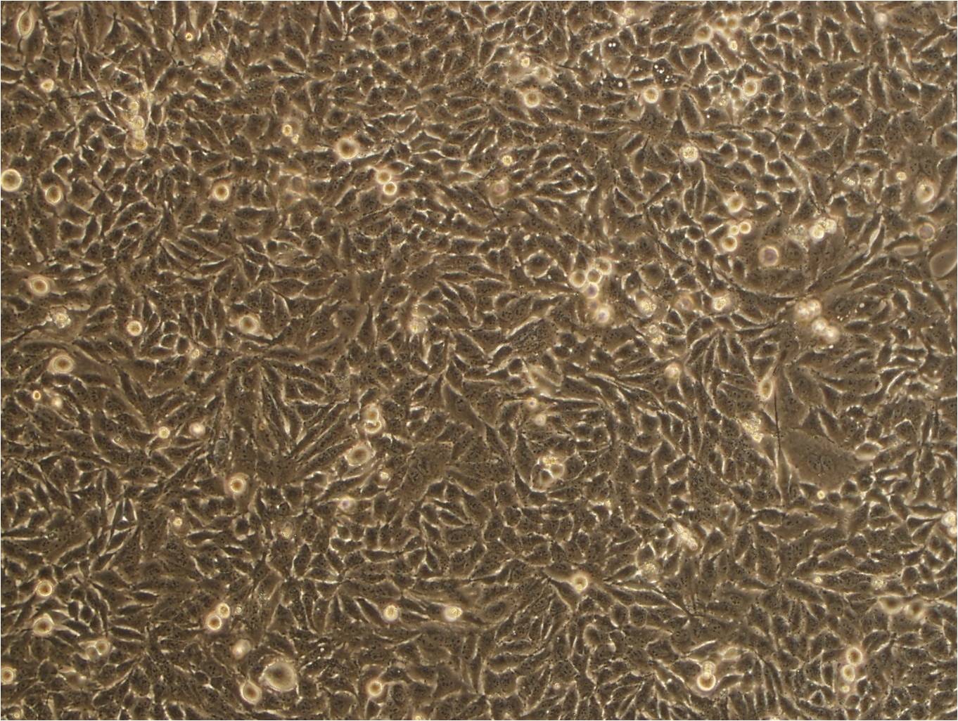 HCC4006 Fresh Cells|人肺癌腺癌细胞(送STR基因图谱)