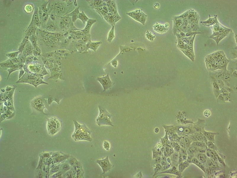 NCI-H1355 Fresh Cells|人非小细胞肺癌细胞(送STR基因图谱)