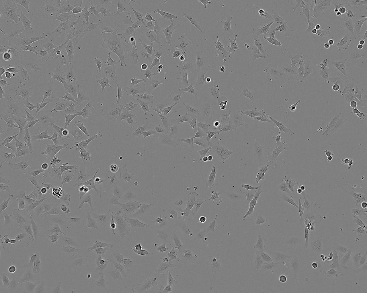 KNS-62 Fresh Cells|人肺支气管鳞状细胞癌细胞(送STR基因图谱)