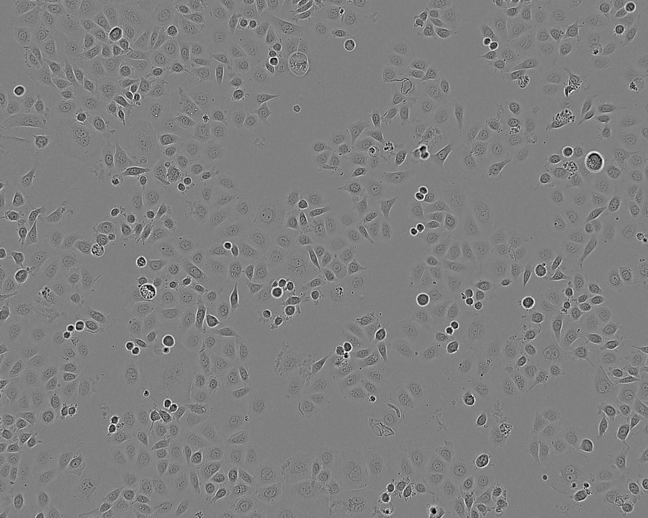 NCI-H2110 Fresh Cells|人非小细胞肺癌细胞(送STR基因图谱)