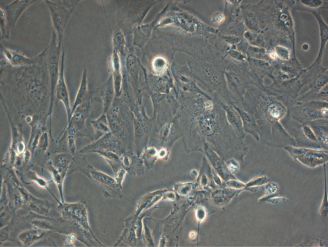 NCI-H1944 Fresh Cells|人非小细胞肺癌细胞(送STR基因图谱)