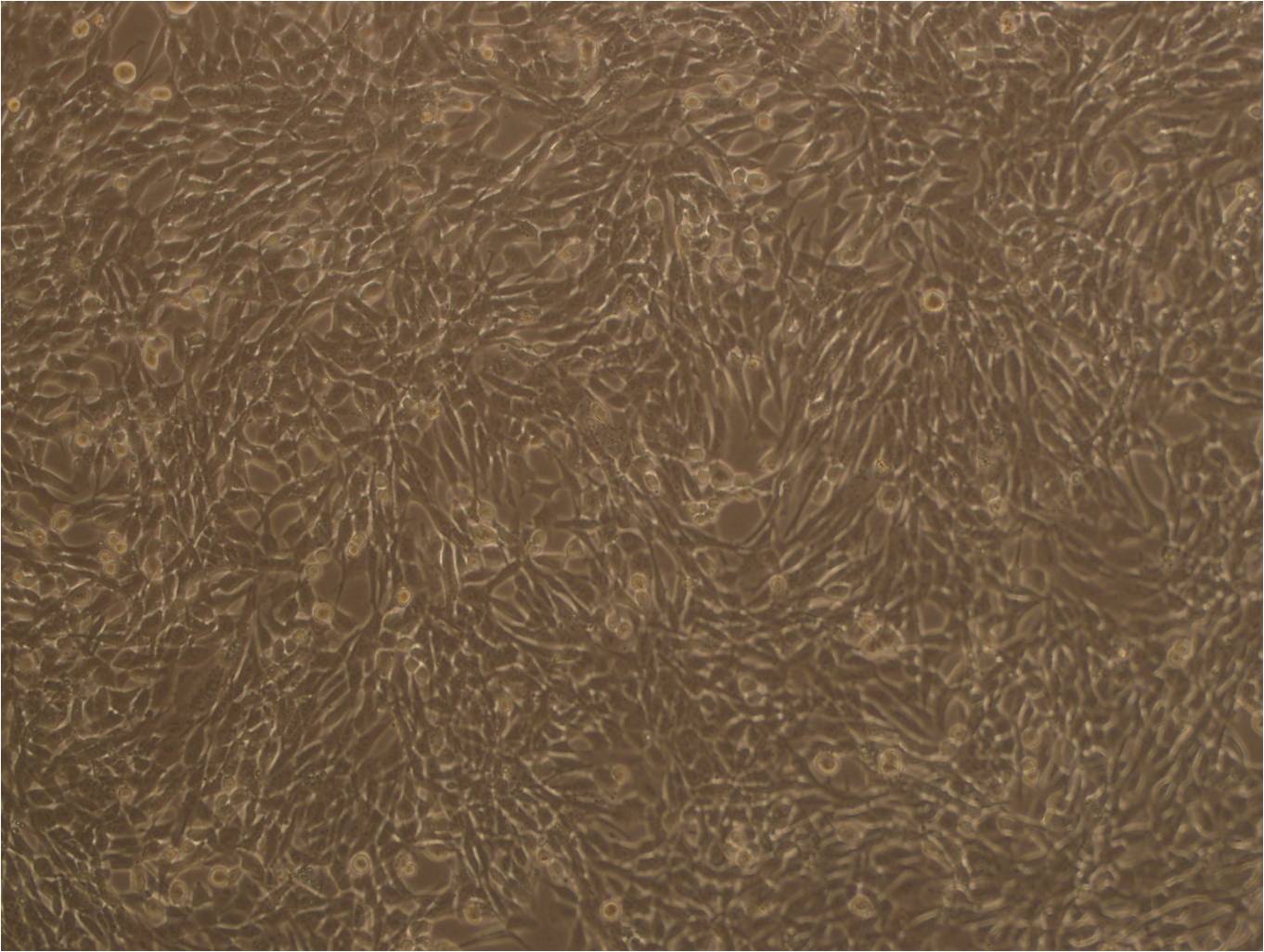 NCI-H2009 Fresh Cells|人肺腺癌细胞(送STR基因图谱)