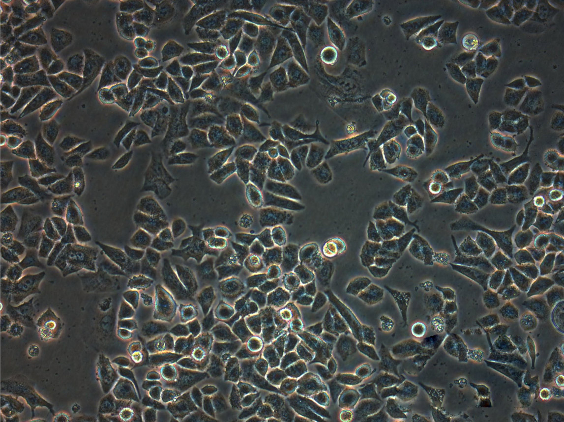 Capan-1 Fresh Cells|人胰腺癌细胞(送STR基因图谱)