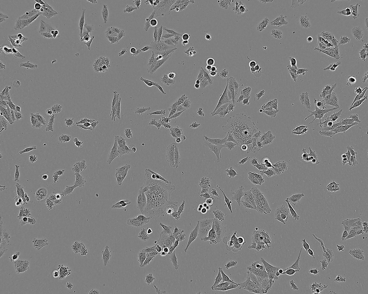 KYSE-30 Fresh Cells|人食道癌细胞(送STR基因图谱)