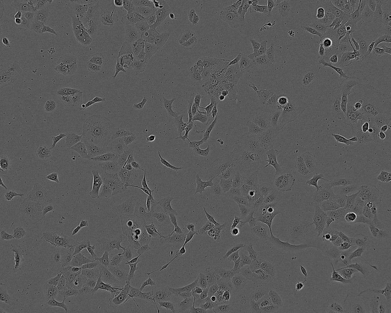 PIG1 Fresh Cells|正常人皮肤黑色素细胞(送STR基因图谱)