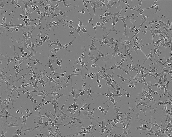 CAL-148 Fresh Cells|人乳腺癌细胞(送STR基因图谱)