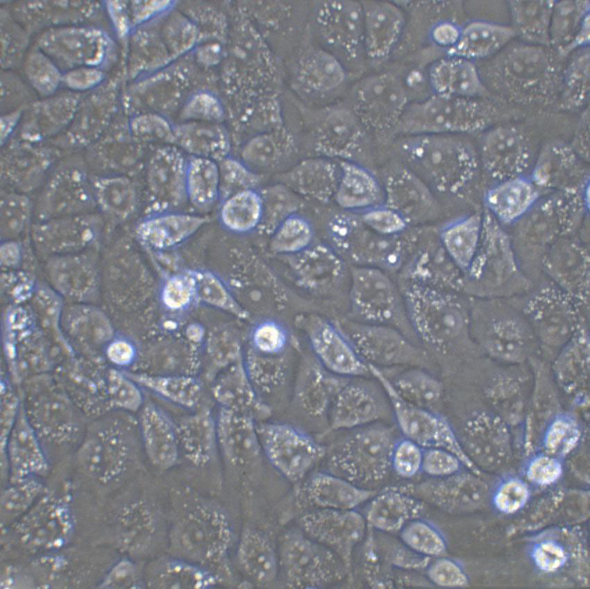 WiDr Fresh Cells|人结直肠癌细胞(送STR基因图谱)