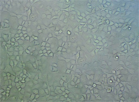 MDA-MB-435 Fresh Cells|人乳腺癌细胞(送STR基因图谱)