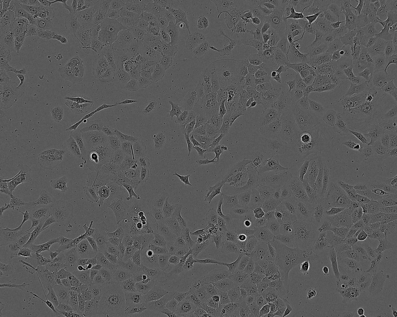 RIN-m5F Fresh Cells|大鼠胰岛β细胞瘤细胞(送STR基因图谱)