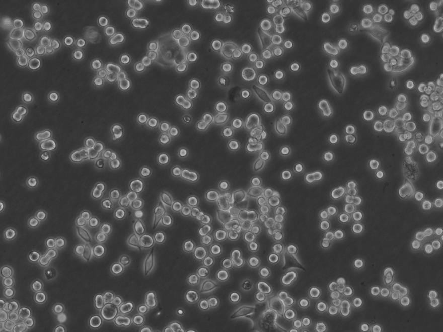 Anti-Amphiphysin:神经元突触前膜蛋白抗体