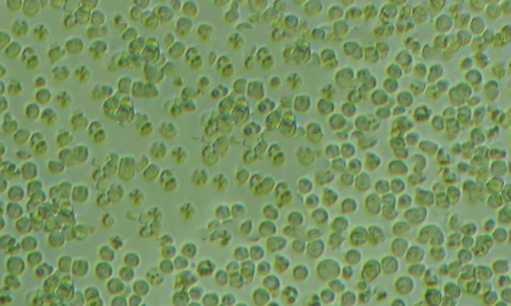 Anti-ATP2c1:钙离子ATP酶通道蛋白抗体