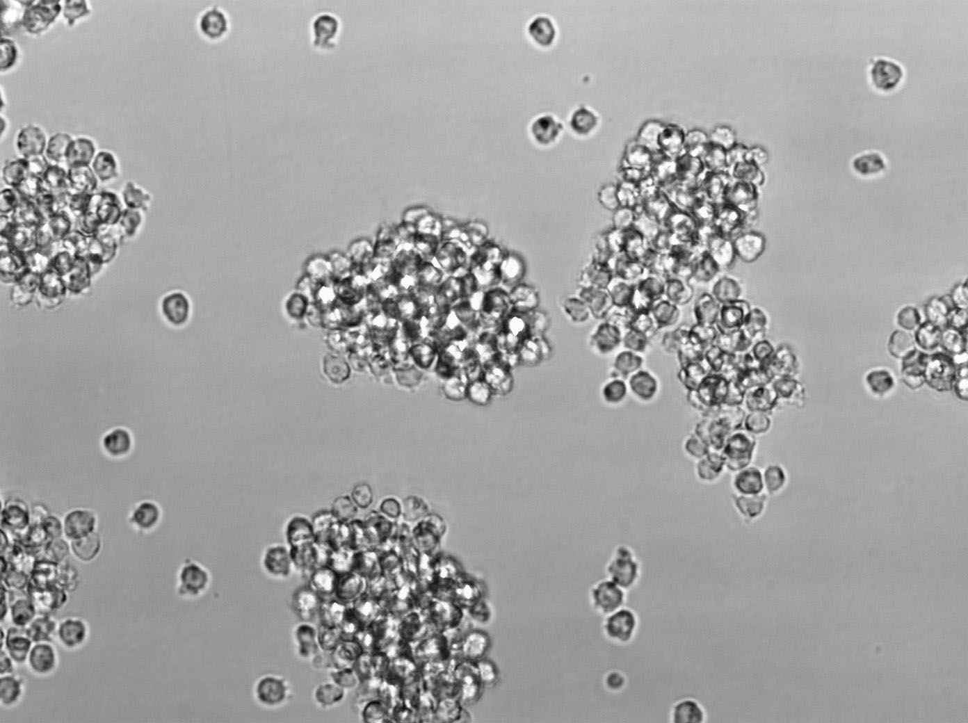 HCC4006 Cells|人肺癌腺癌克隆细胞(包送STR鉴定报告)