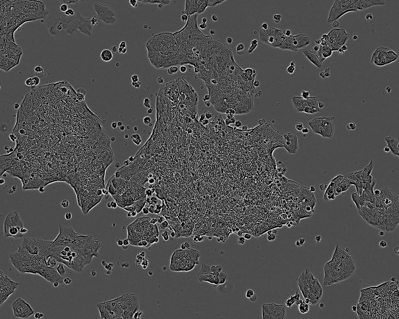 HOS Cells|人骨肉瘤克隆细胞(包送STR鉴定报告)