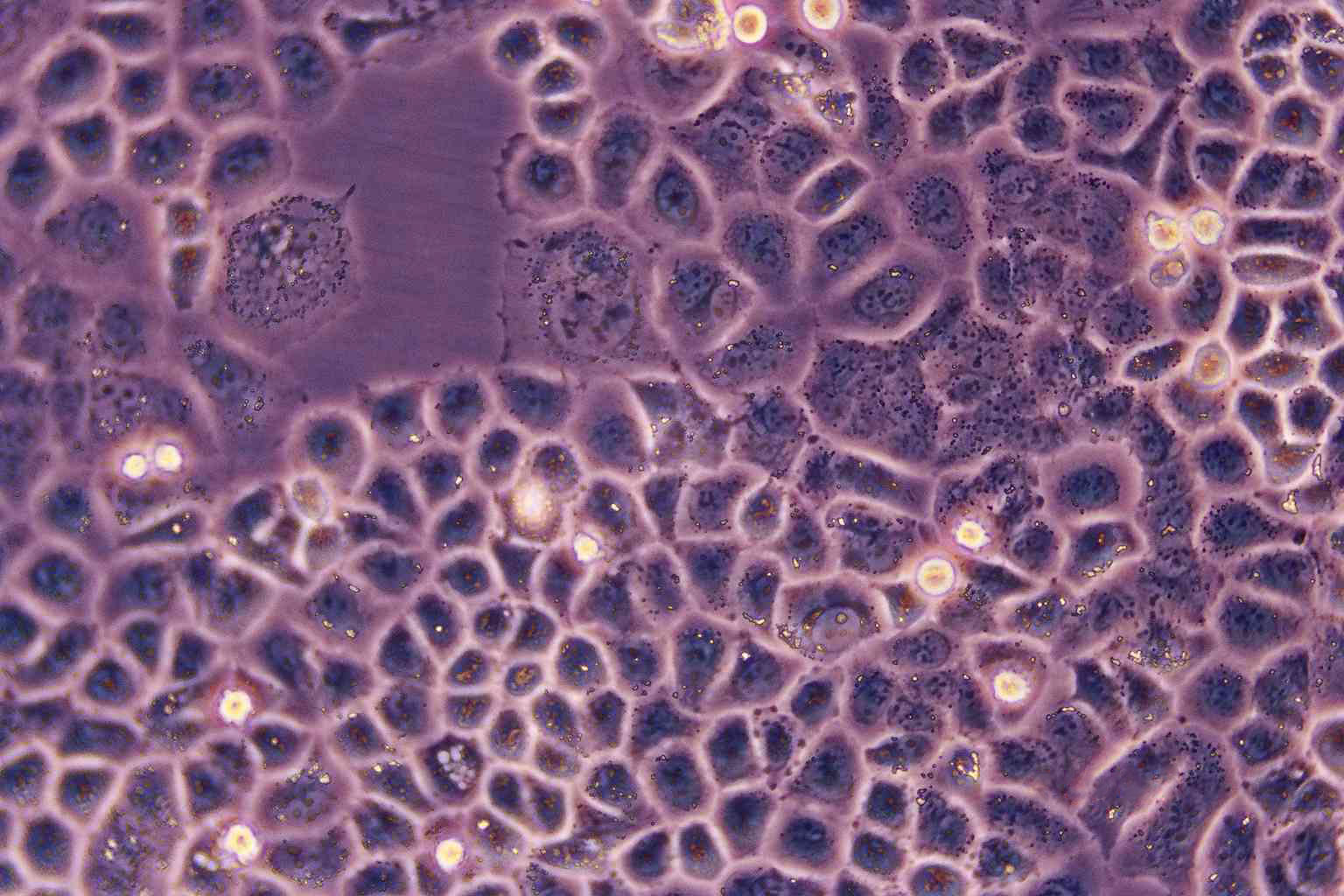 EBC-1:人肺鳞癌复苏细胞(提供STR鉴定图谱)
