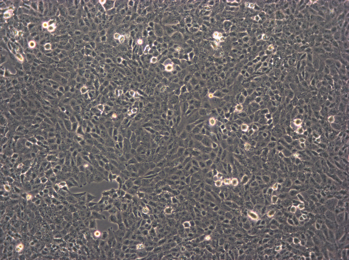 FL 62891:人肝复苏细胞(提供STR鉴定图谱)