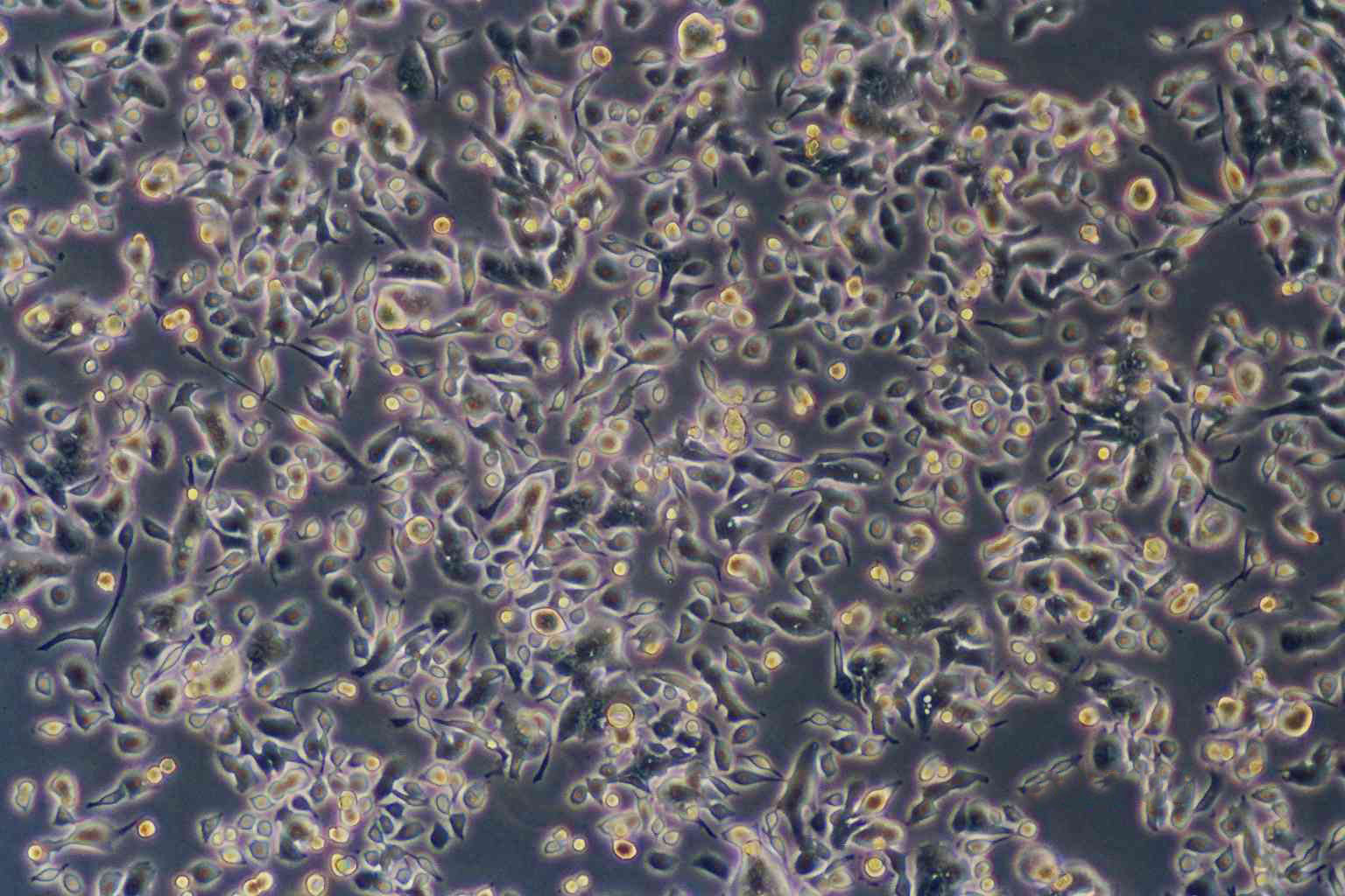 NCI-H187:人视网膜母细胞瘤复苏细胞(提供STR鉴定图谱)