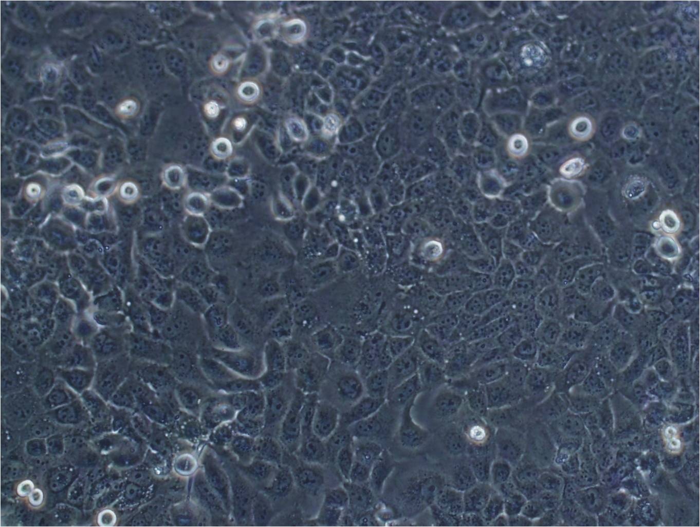U-138MG:人脑神经胶质瘤复苏细胞(提供STR鉴定图谱)