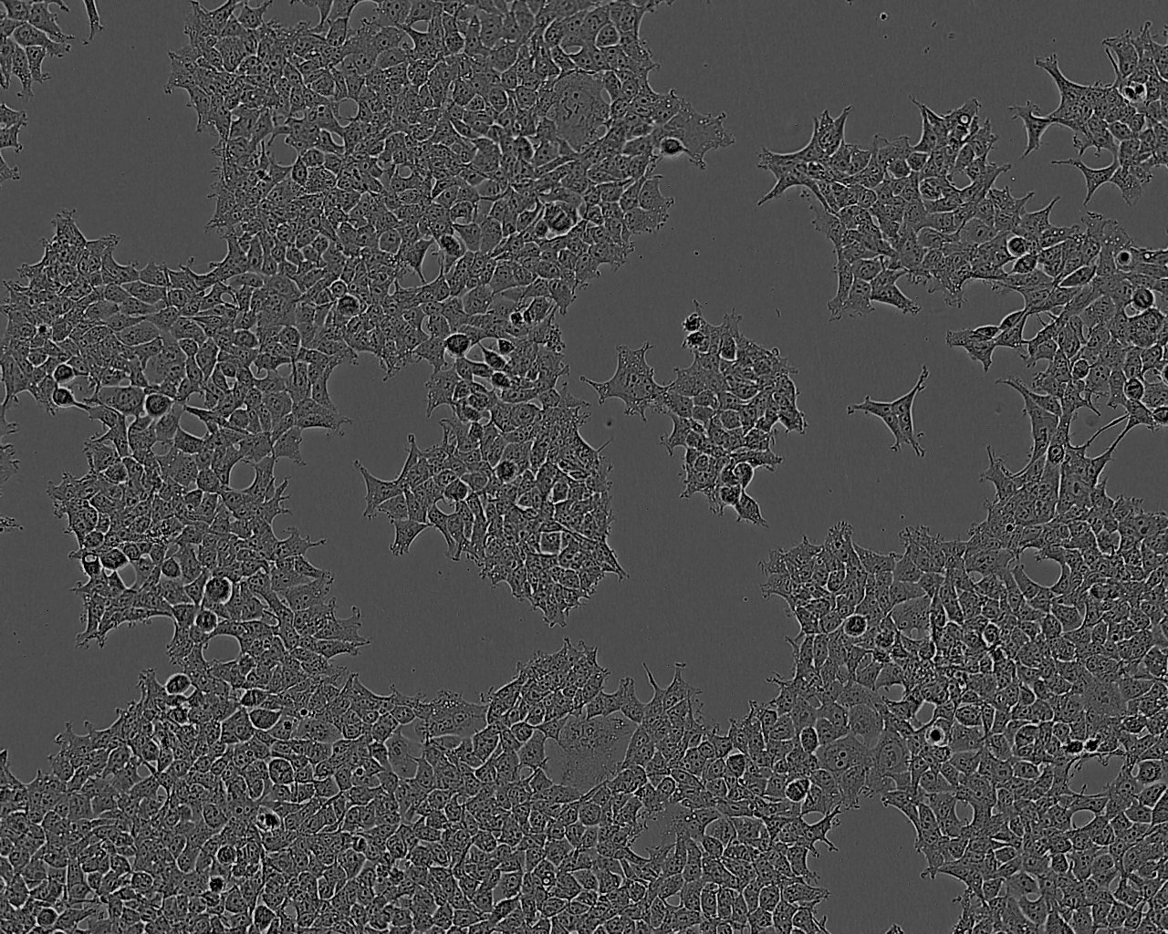 BNL 1ME A.7R.1:小鼠肝上皮复苏细胞(提供STR鉴定图谱)